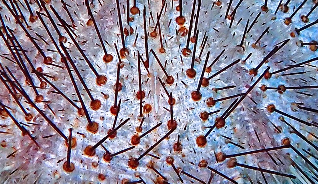 アロポントニア・ブロッキー　